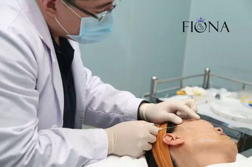 Non-surgical PDO PCL PLACL改装のコグの糸の改装360 4D 6D 12D WのCannula