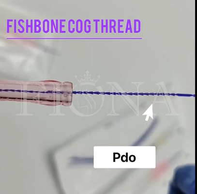 魚の骨の鋳造物のコグの糸