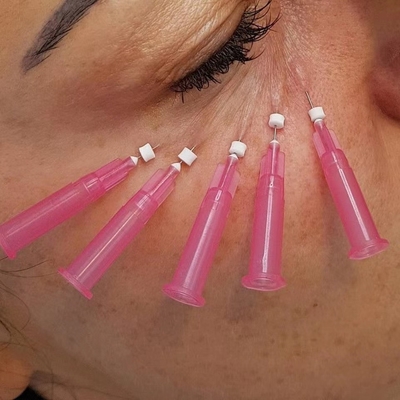25mm Pdo Pclの下の目の容積の損失のための吸収性の糸の上昇Wのタイプ鈍いCannula