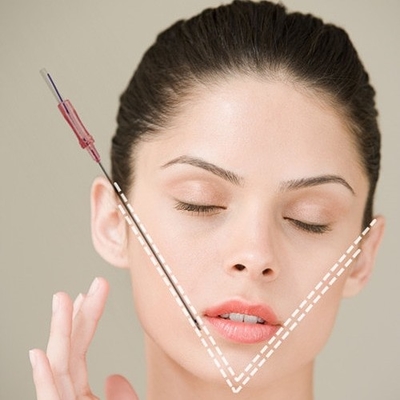 即刻に表面持ち上がることのためのNonsurgical PDOの糸の表面持ち上がるコグの糸18G 100mm