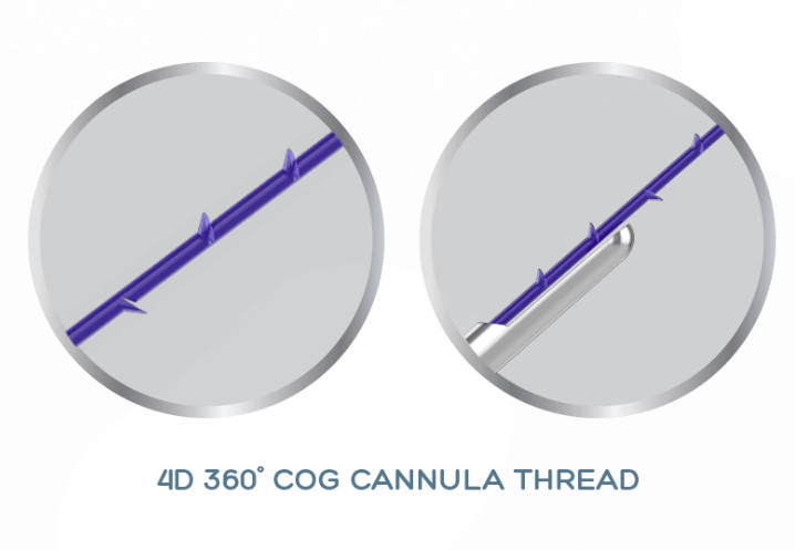 非外科改装のためのPDO PCL PLLA 4DのコグのCannullaの糸の上昇19G-100mm